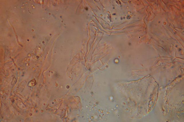 Lignicolo da determinare (Bjerkandera fumosa)